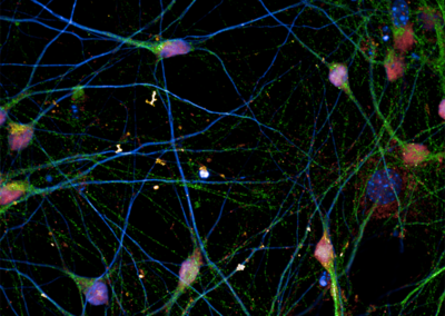 Visualizing Neurons in Culture