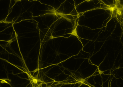 Staining Neurons in Culture