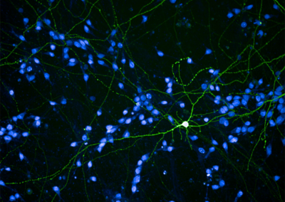 Morphological Analysis of Neurons