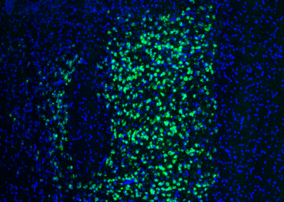 Thalamus Staining