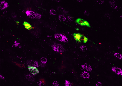 Molecular Characterization by RNAscope