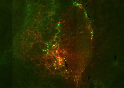 Cell-type Specific Rabies Virus Tracing